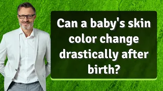 Can a baby's skin color change drastically after birth?