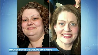 Mulher que perdeu 70 quilos revela três dicas para emagrecer