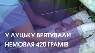 Врятували дитину, яка народилася з вагою 420 грамів