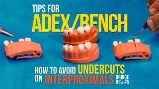 Mastering Tooth Prep. Learn how to avoid undercuts and pass the #benchtest and #adex