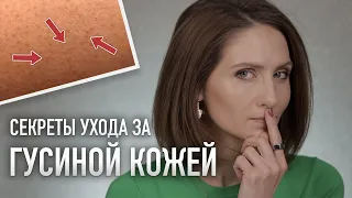 УХОД ЗА ТЕЛОМ ДОМА || Схема ухода при фолликулярном кератозе и любимые средства