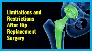 Hip Replacement Surgery In Elderly Seniors: What Are The Restrictions and Limitations ?