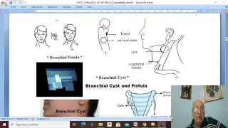 Head and neck surgery in Arabic 4 ( Branchial cyst ) , by Dr. Wahdan .