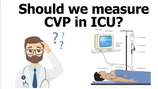 Should we measure CVP in ICU?