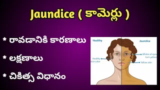 Jaundice ( పచ్చ కామెర్లు ) Causes, Symptoms and Treatment in Telugu.