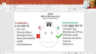 Weber test for ANCC