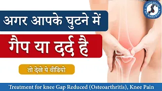 घुटने में गैप (OsteoArthritis) या दर्द का कैसे करें इलाज ? Knee Gap Reduced, Knee Pain Treatment