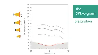 How Technology Helps (Mild Hearing Loss)