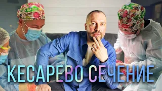 Кесарево сечение. Подробная видео-инструкция для будущих мам. Акушер-гинеколог Иваха Стас