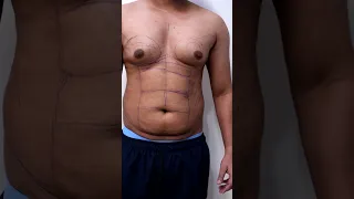 Six Pack Abs | 6 Pack Abs result #shorts