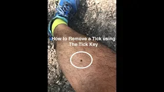 How to Remove a Tick using the Tick Key