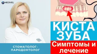 Киста зуба - симптомы, причины, диагностика и лечение кисты зуба!