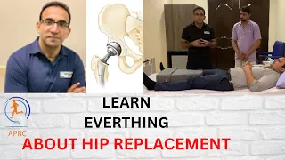 Learn Everything About Hip Replacement |Exercises, Precautions and Complete Recovery |Urdu |Hindi