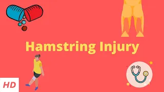 Hamstring injury, Causes, Signs and Symptoms, DIagnosis and Treatment.