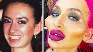 BOTCHED Celebrity Plastic Surgery That Made Them Unrecognizable