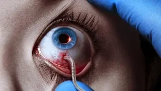 The Strain (TV Series - 2014) Season 1 Trailer