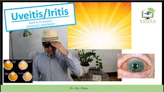 Uveitis/Iritis: signs, symptoms, causes diagnosis and treatments 2020 I Dr Shaz Rehan