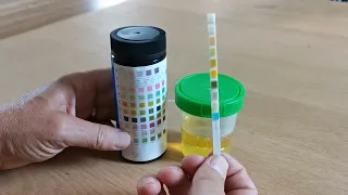 How to use urine test strips 10 parameters