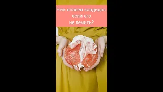 ЧЕМ ОПАСЕН КАНДИДОЗ, ЕСЛИ ЕГО НЕ ЛЕЧИТЬ? ЧЕМ ОПАСНА МОЛОЧНИЦА?