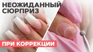 Клюющие ногти | Форма балерина | Онихолизис