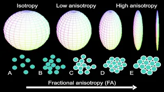 Introduction to Diffusion Tensor Imaging and NODDI