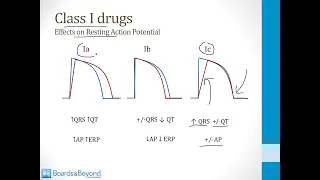 Cardiology Step 1  — Antiarrhtyhmic Drugs — Boards and Beyond