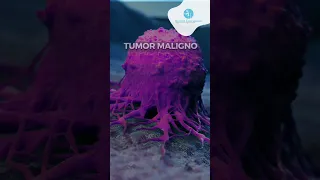 Tumor Maligno / Tumor Benigno