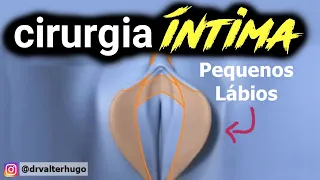 CIRURGIA INTIMA Antes e Depois : Você teria coragem de fazer ?