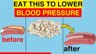 ❣️ 10 BEST High Potassium Foods to LOWER Your Blood Pressure Naturally (NOT BANANAS)