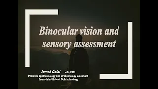 Binocular sensory assessment- Binocular vision.Dr. Sameh Galal