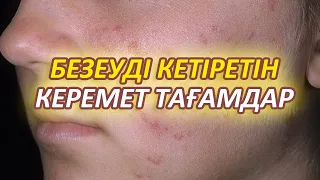 Безеуді қалай кетіруге болады, БЕЗЕУ КЕТІРЕТІН КҮШТІ ТАҒАМДАР, Керек арнасы