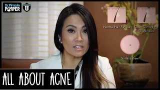 All About Acne - with Dr. Sandra Lee