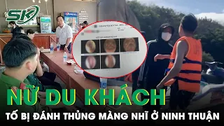 Xác Minh Vụ Nữ Du Khách Tố Bị Đánh Thủng Màng Nhĩ Ở Ninh Thuận | SKĐS
