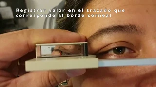 Tutorial Exoftalmometria de Hertel