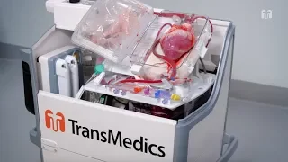 Organ Care System (OCS™) Heart
