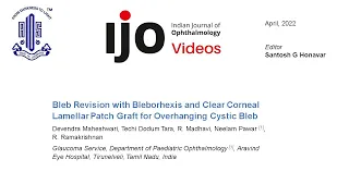 Bleb Revision with Bleborhexis and Clear Corneal Lamellar Patch Graft for Overhanging Cystic Bleb