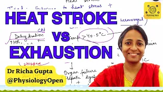 Heat syncope, heat cramps, heat exhaustion vs heat stroke |  medicine mbbs lecture