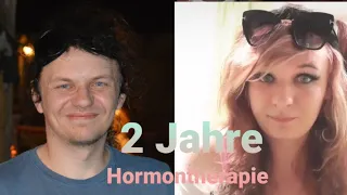 2 Jahre auf Östrogene / Update zu meiner MtF Transgender Hormontherapie