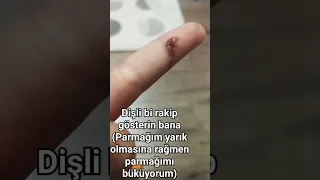 keşke yapmasaydım parmağım acıdan ölüyo