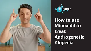 How to use Minoxidil to Treat Androgenetic Alopecia
