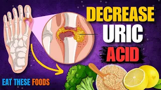 10 Best Foods to Lower High Uric Acid in the Blood | Best Vegetables For Uric Acid Patients