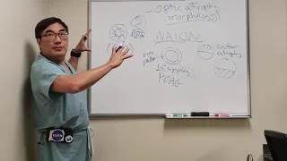 Optic Atrophy - Disc Morphology