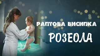 Раптова висипка. Розеола