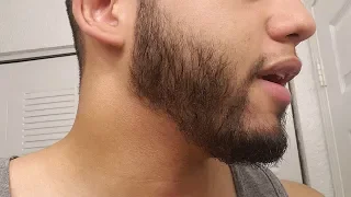 10% Minoxidil Beard FTW| Minox beard update week 54