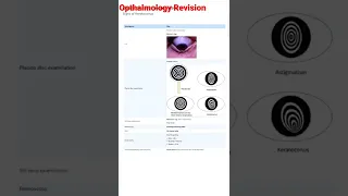 #mbbs #opthalmology Signs of Keratoconus (NEETPG)