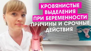 Кровянистые выделения при беременности. Причины и срочные действия