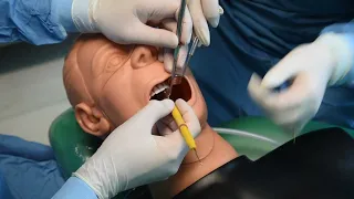 Tecnica Passaferri in Odontoiatria