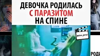 ДЕВОЧКА РОДИЛАСЬ С ПАРАЗИТОМ НА СПИНЕ. Название: "Злое" 2021г.