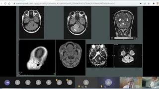 5.Case discussion (Neuroradiology) by Dr. Khaled Gad&Spot cases by Dr. Hesham Elsheikh