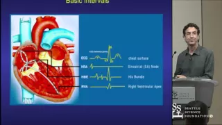 Basics of EP Testing and Ablation by Adam Zivin, M.D.